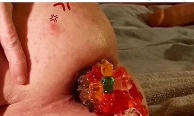 Big Load Of Gummy Bears Anal Stuffing And Expulsion Whit Prolapse